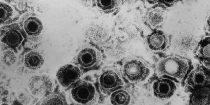 15285-herpes-simplex-virus-tem-b82-0474-lores