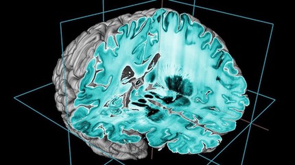 high-res-brain-3D